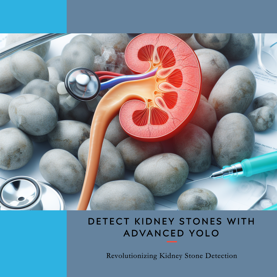 Image for Project Revolutionizing Kidney Stone Detection with Advanced YOLO